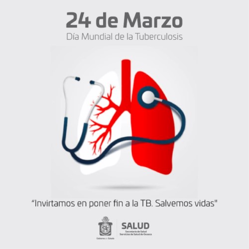 ·         Hoy se conmemora el Día Mundial de la Tuberculosis