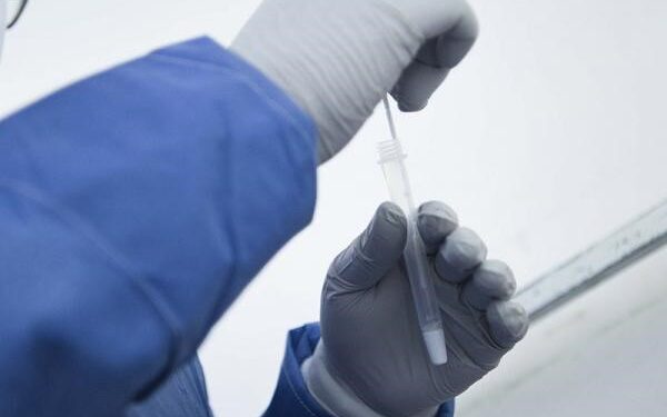 Suma Puebla siete nuevos contagios por COVID-19: Salud